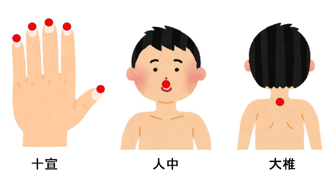 熱中症の漢方療法とツボ：救急外来でのアプローチ | 加納渡辺病院| 岐阜市 乳腺外来・痔核手術・内視鏡・漢方外来