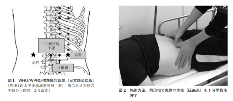 尿管結石の痛みを即効で和らげる漢方とツボ:救急外来の現場から | 加納渡辺病院| 岐阜市 乳腺外来・痔核手術・内視鏡・漢方外来